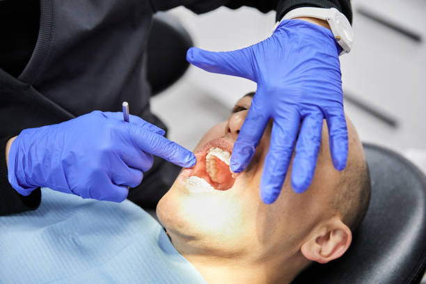 Best Lost Filling or Crown Replacement in Bellport, NY